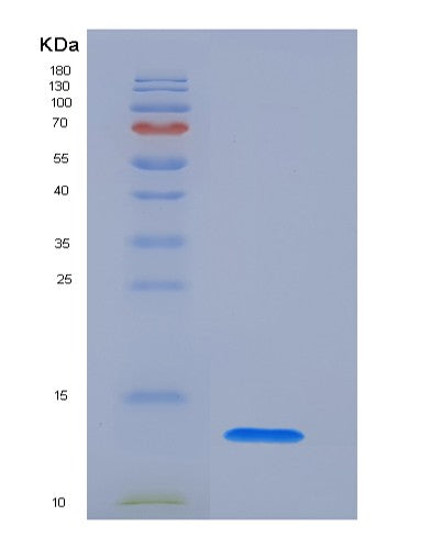 Human SLPI (Antileukoproteinase) - Recombinant Protein