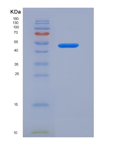 Mouse Il10rb (Interleukin-10 Receptor Subunit Beta) - Recombinant Protein