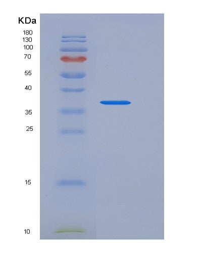 Human FAM171B (Protein Fam171B) - Recombinant Protein