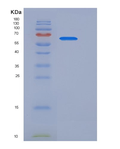 Human WFIKKN2 (Wap, Kazal, Immunoglobulin, Kunitz And Ntr Domain-Containing Protein 2) - Recombinant Protein