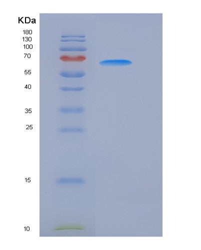 Human RET Kinase - Recombinant Protein