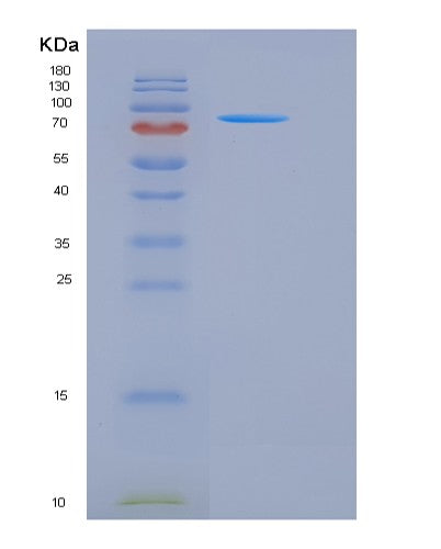 Mouse Camk4 (Calcium/Calmodulin-Dependent Protein Kinase Type Iv) - Recombinant Protein