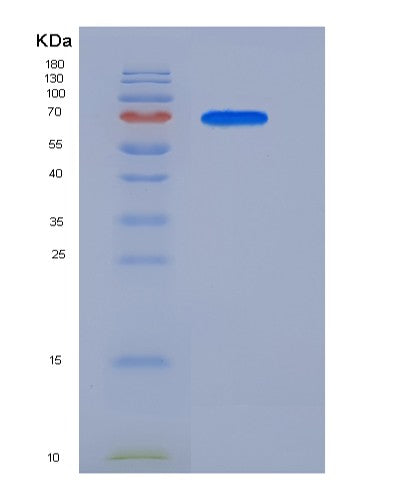 Human CROT (Peroxisomal Carnitine O-Octanoyltransferase) - Recombinant Protein