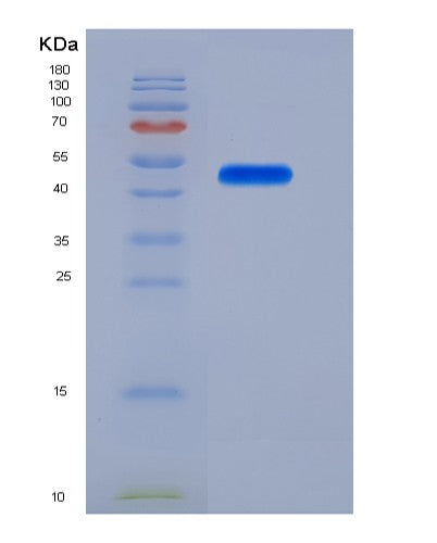 Human LRP10 (Low-Density Lipoprotein Receptor-Related Protein 10) - Recombinant Protein