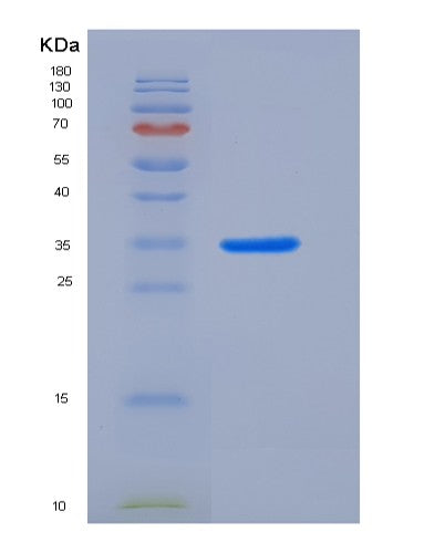 Human FANCA (Fanconi Anemia Group A Protein) - Recombinant Protein