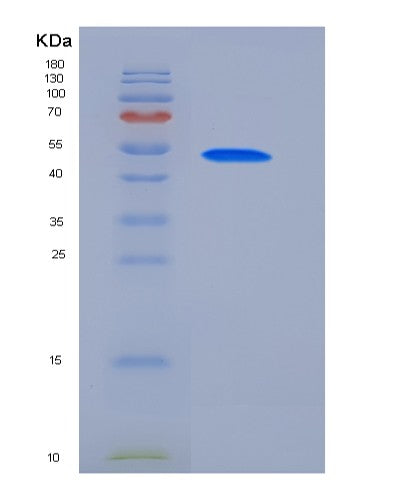 Human ALPI (Intestinal-Type Alkaline Phosphatase) - Recombinant Protein