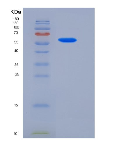 Human STC2 (Stanniocalcin-2) - Recombinant Protein