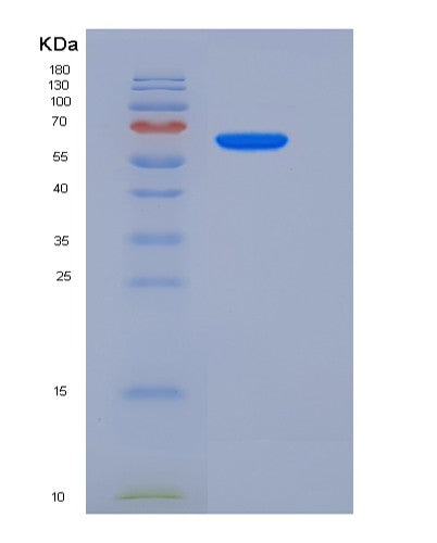 Human KMT5C (Histone-Lysine N-Methyltransferase Kmt5C) - Recombinant Protein