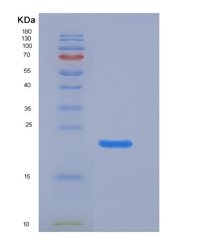 Mouse Klrb1a (Killer Cell Lectin-Like Receptor Subfamily B Member 1A) - Recombinant Protein