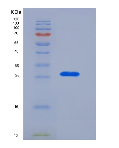 Human RPE (Ribulose-Phosphate 3-Epimerase) - Recombinant Protein