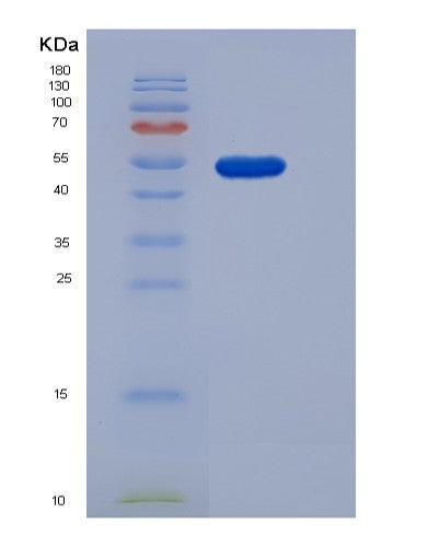 Human PNLIP (Pancreatic Triacylglycerol Lipase) - Recombinant Protein