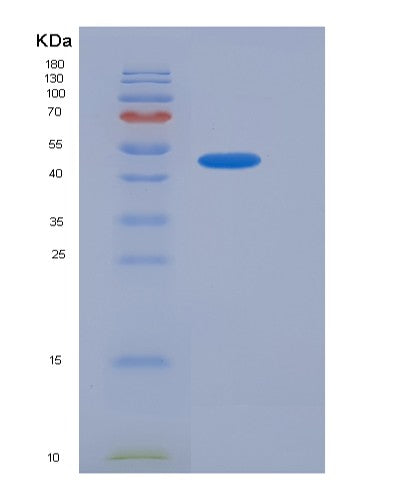 Human SMPDL3A (Cyclic Gmp-Amp Phosphodiesterase Smpdl3A) - Recombinant Protein