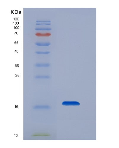 Mouse Cd79b (B-Cell Antigen Receptor Complex-Associated Protein Beta Chain) - Recombinant Protein