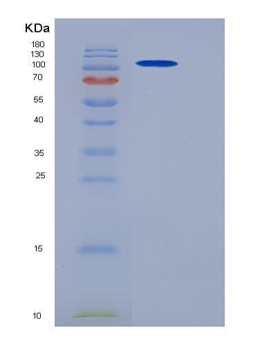 Mouse Parp1 (Poly [Adp-Ribose] Polymerase 1) - Recombinant Protein
