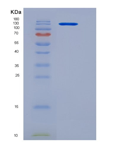 Human CSN3 (Kappa-Casein) - Recombinant Protein