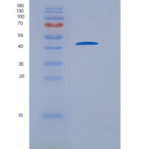Mouse St6gal1 (Beta-Galactoside Alpha-2,6-Sialyltransferase 1) - Recombinant Protein