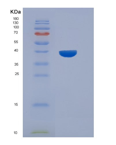 Human OMG (Oligodendrocyte-Myelin Glycoprotein) - Recombinant Protein
