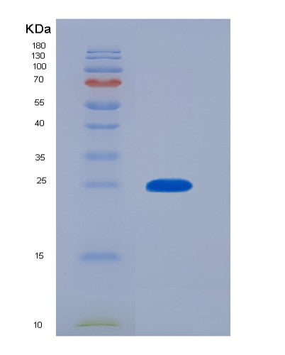 Human IL10RB (Interleukin-10 Receptor Subunit Beta) - Recombinant Protein