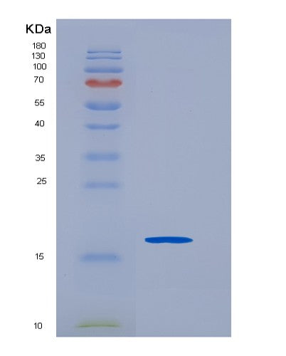 Human SCN3B (Sodium Channel Regulatory Subunit Beta-3) - Recombinant Protein