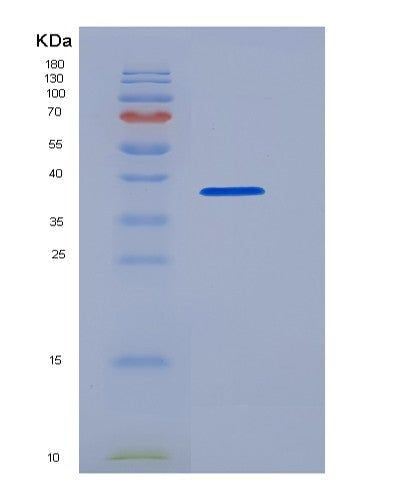 Human POPDC1 (Popeye Domain-Containing Protein 1) - Recombinant Protein