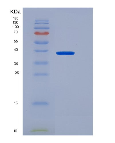 Human IL13RA1 (Interleukin-13 Receptor Subunit Alpha-1) - Recombinant Protein
