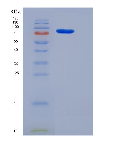 Human RACK1 (Small Ribosomal Subunit Protein Rack1) - Recombinant Protein