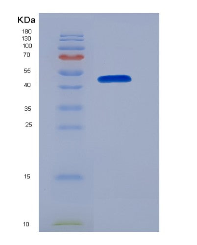 Mouse Smad5 (Mothers Against Decapentaplegic Homolog 5) - Recombinant Protein