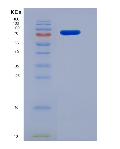 Mouse Smad5 (Mothers Against Decapentaplegic Homolog 5) - Recombinant Protein