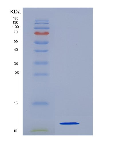 Human S100A6 (Protein S100-A6) - Recombinant Protein