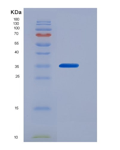 Human CALU (Calumenin) - Recombinant Protein
