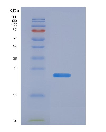 Human TIMP1 (Metalloproteinase Inhibitor 1) - Recombinant Protein
