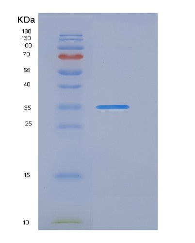 Human JTB (Protein Jtb) - Recombinant Protein