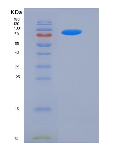 Human FSTL5 (Follistatin-Related Protein 5) - Recombinant Protein