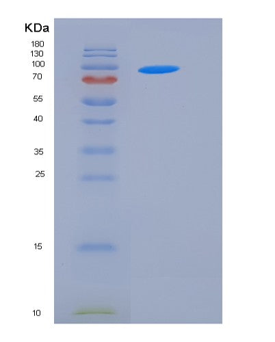 Human STXBP3 (Syntaxin-Binding Protein 3) - Recombinant Protein