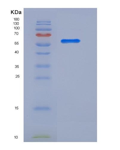 Human LRG1 (Leucine-Rich Alpha-2-Glycoprotein) - Recombinant Protein