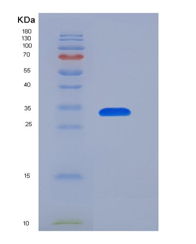 Human CXCL8 (Interleukin-8) - Recombinant Protein