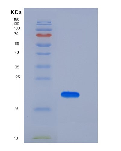 Human IL10 (Interleukin-10) - Recombinant Protein