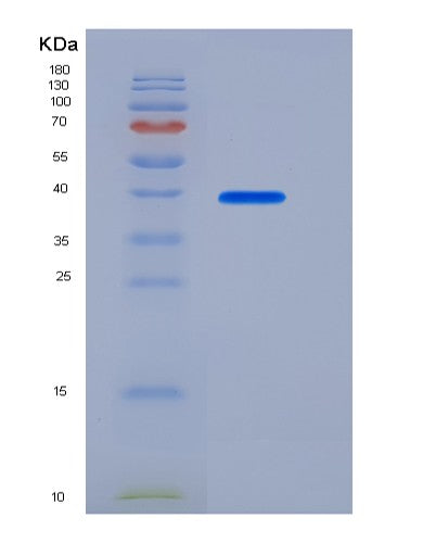 Human BMP2 (Bone Morphogenetic Protein 2) - Recombinant Protein