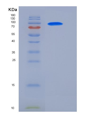 Human GAD2 (Glutamate Decarboxylase 2) - Recombinant Protein