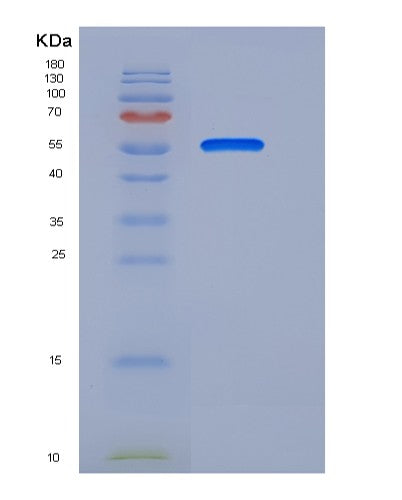 Human ANTXR1 (Anthrax Toxin Receptor 1) - Recombinant Protein