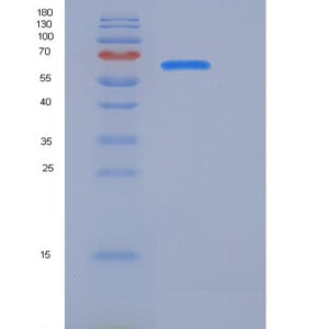 Human CDCP1 (Cub Domain-Containing Protein 1) - Recombinant Protein