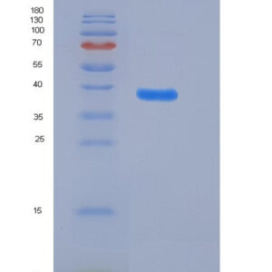 Human ADM (Pro-Adrenomedullin) - Recombinant Protein