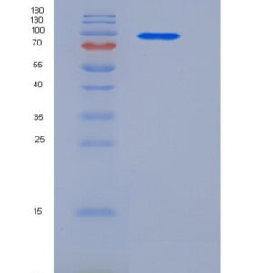 Human NRP1 (Neuropilin-1) - Recombinant Protein
