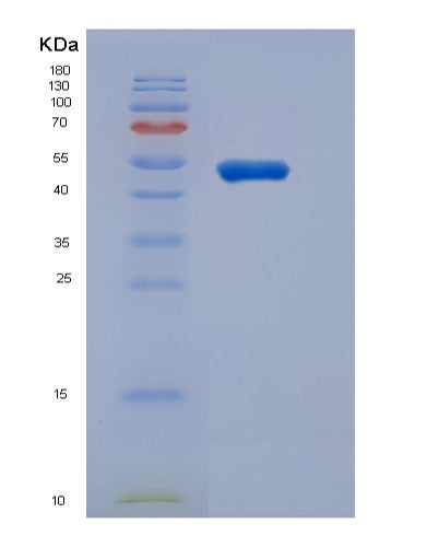 Mouse Ghrhr (Growth Hormone-Releasing Hormone Receptor) - Recombinant Protein