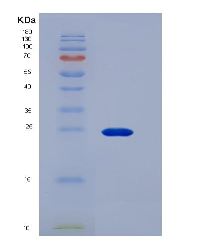 Human FCGR3A (Low Affinity Immunoglobulin Gamma Fc Region Receptor Iii-A) - Recombinant Protein