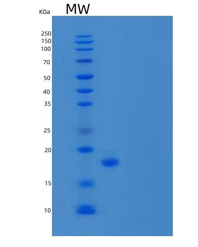 Human AGR3 (Anterior Gradient Protein 3) - Recombinant Protein