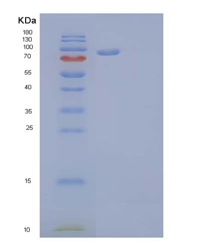 Human OSMR (Oncostatin-M-Specific Receptor Subunit Beta) - Recombinant Protein