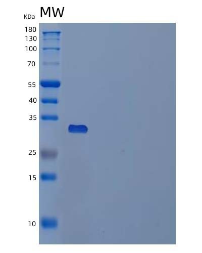 Human PPT1 (Palmitoyl-Protein Thioesterase 1) - Recombinant Protein