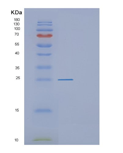 Mouse F3 (Tissue Factor) - Recombinant Protein
