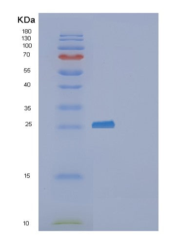 Human F3 (Tissue Factor) - Recombinant Protein